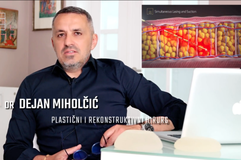 Dejan Miholčić & Laserska liposukcija